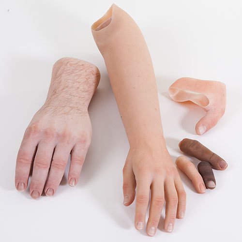 Custom Silicone Hands, Cosmetic Devices, Upper Limb Prosthetics, Prosthetics